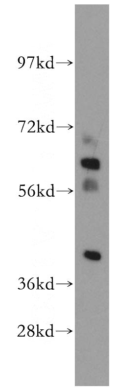 mouse testis tissue were subjected to SDS PAGE followed by western blot with Catalog No:109916(DHDH antibody) at dilution of 1:500