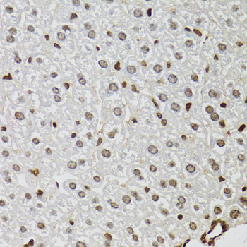 Immunohistochemistry - KDM4A Polyclonal Antibody 