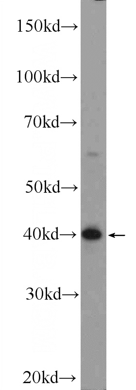 mouse brain tissue were subjected to SDS PAGE followed by western blot with Catalog No:108155(ARMCX3 Antibody) at dilution of 1:600
