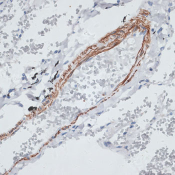 Immunohistochemistry - TPM1 Polyclonal Antibody 