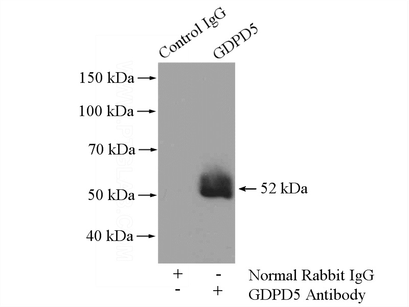 IP Result of anti-GDPD5 (IP:Catalog No:110930, 4ug; Detection:Catalog No:110930 1:500) with mouse skeletal muscle tissue lysate 3600ug.