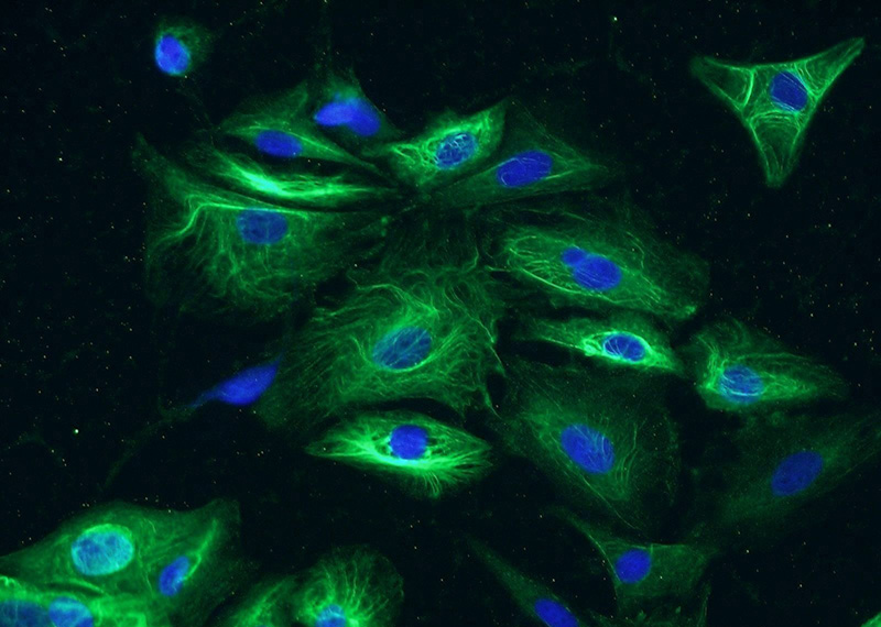 Immunofluorescent analysis of A549 cells using Catalog No:112706(MMP3 Antibody) at dilution of 1:50 and Alexa Fluor 488-congugated AffiniPure Goat Anti-Rabbit IgG(H+L)