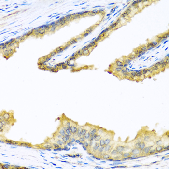 Immunohistochemistry - PENK Polyclonal Antibody 