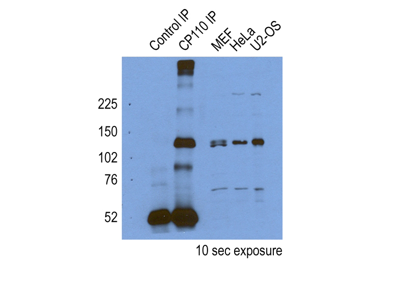 IP result of CP110(Catalog No:109504) by Dr. Corbit, Kevin.