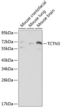 Western blot - TCTN3 Polyclonal Antibody 