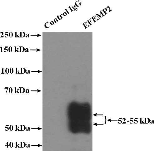 IP Result of anti-EFEMP2 (IP:Catalog No:110206, 4ug; Detection:Catalog No:110206 1:500) with mouse kidney tissue lysate 4000ug.