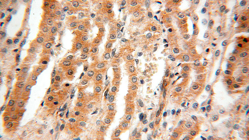Immunohistochemical of paraffin-embedded human kidney using Catalog No:110298(EDAR antibody) at dilution of 1:100 (under 40x lens)