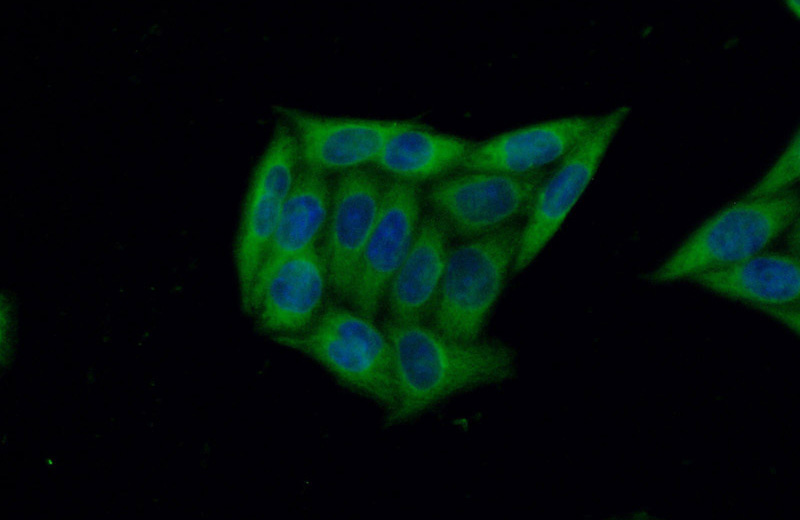 Immunofluorescent analysis of (-20oc Ethanol) fixed HeLa cells using Catalog No:108251(ARFGAP2 Antibody) at dilution of 1:50 and Alexa Fluor 488-congugated AffiniPure Goat Anti-Rabbit IgG(H+L)