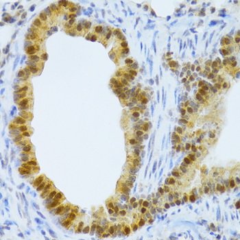 Immunohistochemistry - TAF1C Polyclonal Antibody 
