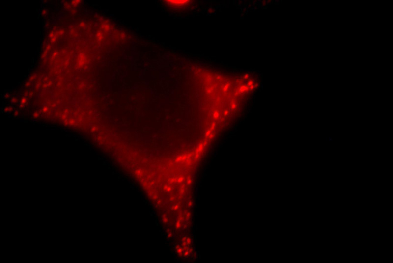 Immunofluorescent analysis of HepG2 cells, using DSTYK antibody Catalog No:114717 at 1:25 dilution and Rhodamine-labeled goat anti-rabbit IgG (red).