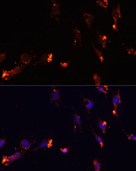 Immunofluorescence - IKBKE Polyclonal Antibody 