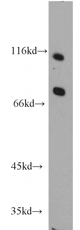 PC-3 cells were subjected to SDS PAGE followed by western blot with Catalog No:108048(AR antibody) at dilution of 1:1000