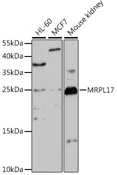Western blot - MRPL17 Polyclonal Antibody 