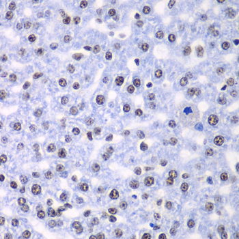Immunohistochemistry - SF3B2 Polyclonal Antibody 