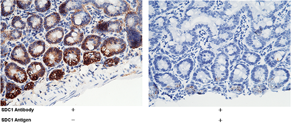 Syndecan-1 / SDC1 / CD138 Antibody, Rabbit PAb, Antigen Affinity Purified, Immunohistochemistry