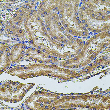 Immunohistochemistry - ALIX / PDCD6IP Polyclonal Antibody 