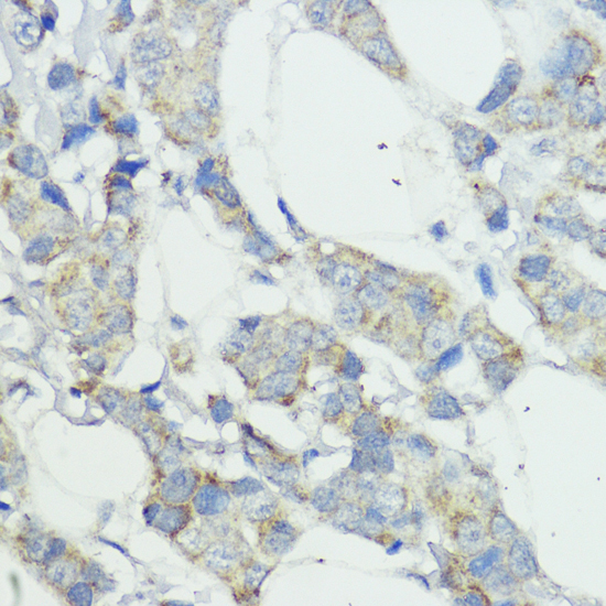 Immunohistochemistry - NOD1 Polyclonal Antibody 