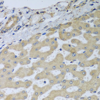 Immunohistochemistry - ATAD3B Polyclonal Antibody 