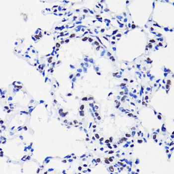 Immunohistochemistry - Acetyl-Histone H2B-K15 pAb 