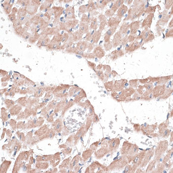 Immunohistochemistry - JMJD7 Polyclonal Antibody 