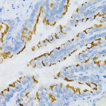 Immunohistochemistry - PTGER2 Polyclonal Antibody 