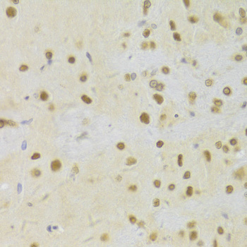 Immunohistochemistry - HDGF Polyclonal Antibody 