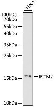 Western blot - IFITM2 Polyclonal Antibody. Western blot analysis of extracts of HeLa cells, using IFITM2 antibody at 1:1000 dilution.Secondary antibody: HRP Goat Anti-Rabbit IgG at 1:10000 dilution.Lysates/proteins: 25ug per lane.Blocking buffer: 3% nonfat dry milk in TBST.Exposure time: 60s.