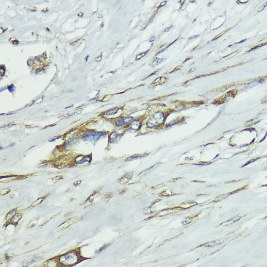 Immunohistochemistry - SOCS5 Polyclonal Antibody 