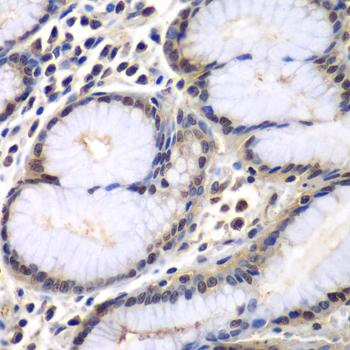 Immunohistochemistry - PSMB2 Polyclonal Antibody 
