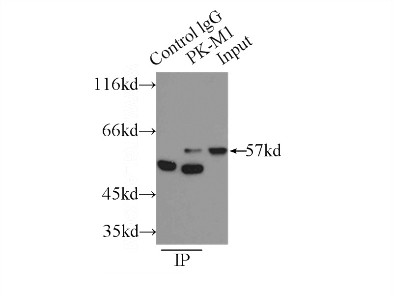 IP Result of anti-PK-M1-specific (IP:Catalog No:113860, 3ug; Detection:Catalog No:113860 1:1000) with mouse brain tissue lysate 4000ug.