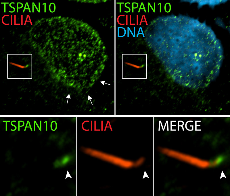 IF result (nuclear and the base of cilia stain) of anti-TSPAN10 (Catalog No:116441, 1:50) with human hTERT-RPE1 (MeOH fixation) cells by Dr. Moshe Kim.