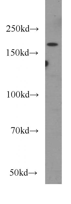 MCF7 cells were subjected to SDS PAGE followed by western blot with Catalog No:113047(NCOR2 antibody) at dilution of 1:300