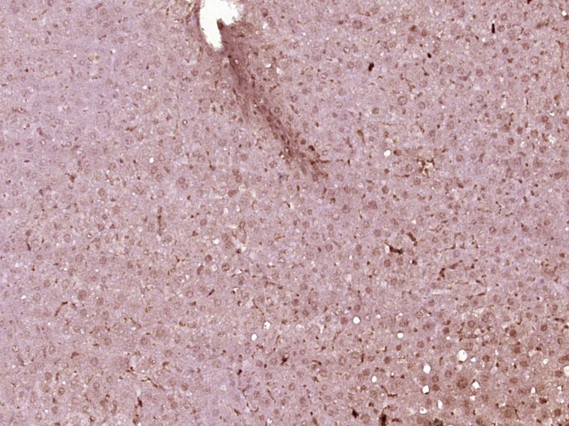 Fig1: Paraformaldehyde-fixed, paraffin embedded (Mouse liver); Antigen retrieval by boiling in sodium citrate buffer (pH6.0) for 15min; Block endogenous peroxidase by 3% hydrogen peroxide for 20 minutes; Blocking buffer (normal goat serum) at 37℃ for 30min; Antibody incubation with (HNF1A) Polyclonal Antibody, Unconjugated at 1:400 overnight at 4℃, followed by operating according to SP Kit(Rabbit) (sp-0023) instructionsand DAB staining.