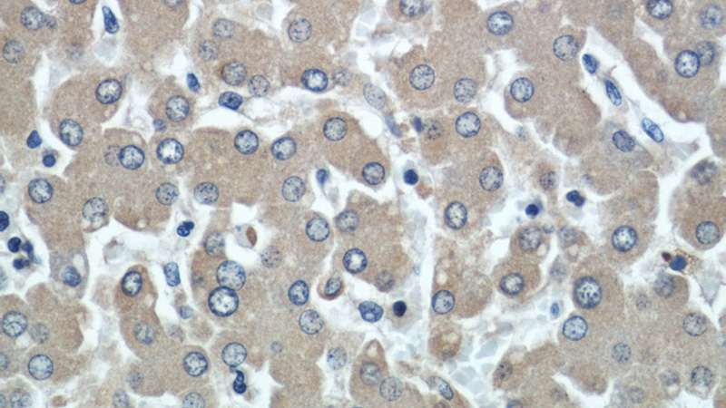 Immunohistochemical of paraffin-embedded human liver using Catalog No:107574(SERPINA3,AACT antibody) at dilution of 1:50 (under 40x lens)