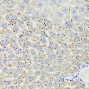 Immunohistochemistry - HSD17B13 Polyclonal Antibody 