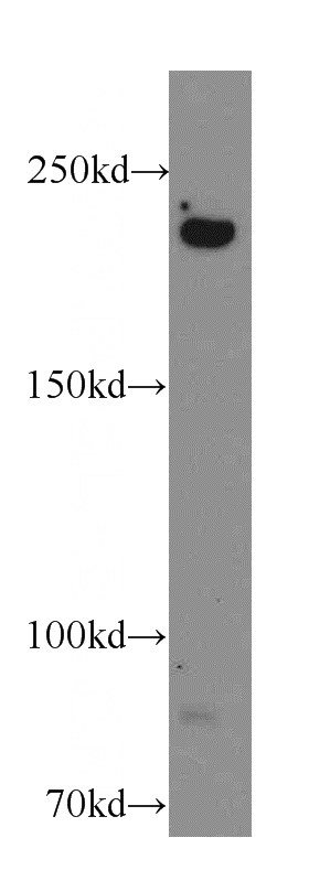 A431 cells were subjected to SDS PAGE followed by western blot with Catalog No:109323(CIT antibody) at dilution of 1:300