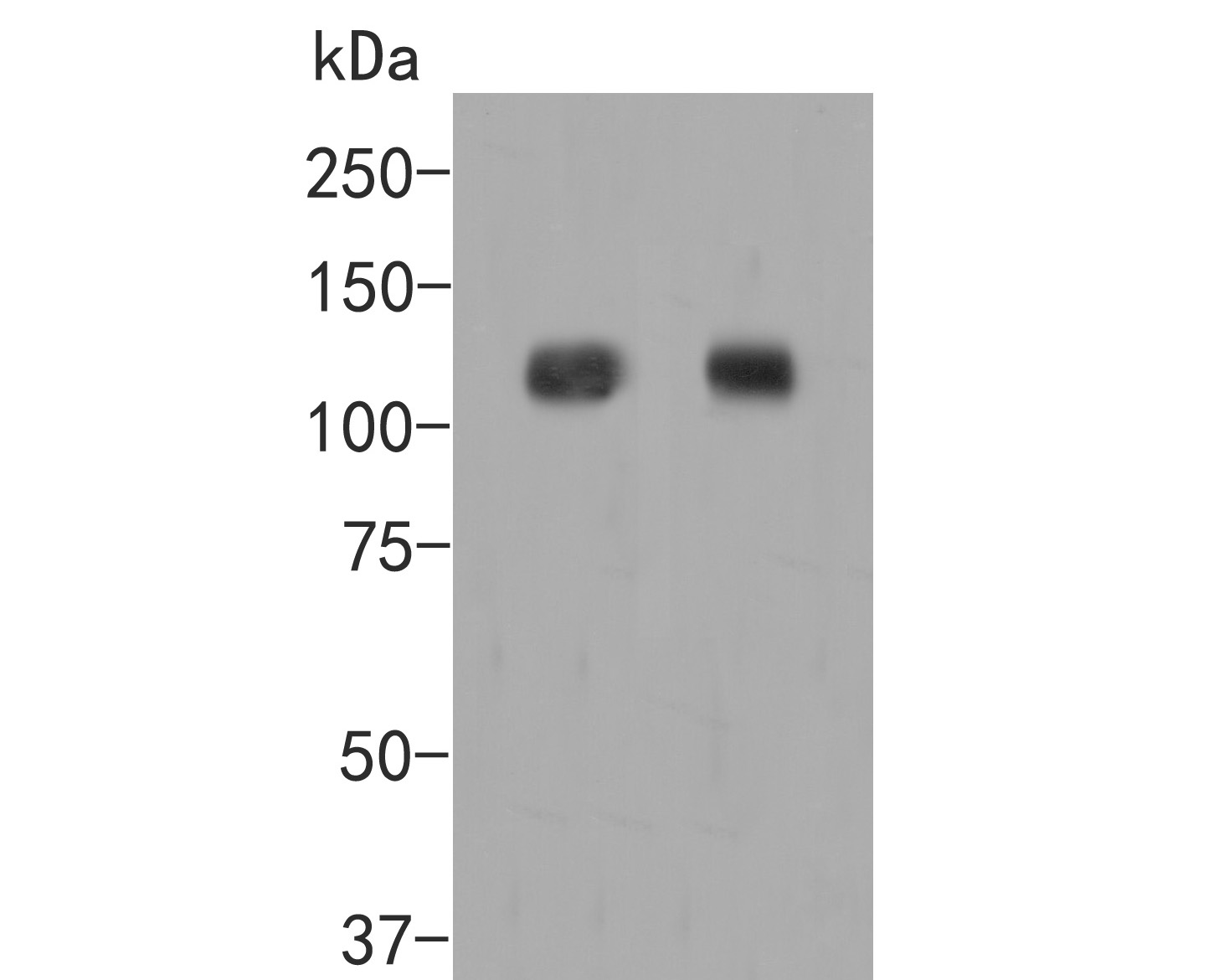 Fig1:; Western blot analysis of EPHA2 on different lysates. Proteins were transferred to a PVDF membrane and blocked with 5% BSA in PBS for 1 hour at room temperature. The primary antibody ( 1/500) was used in 5% BSA at room temperature for 2 hours. Goat Anti-Rabbit IgG - HRP Secondary Antibody (HA1001) at 1:5,000 dilution was used for 1 hour at room temperature.; Positive control:; Lane 1: A549 cell lysate; Lane 2: PC-3M cell lysate