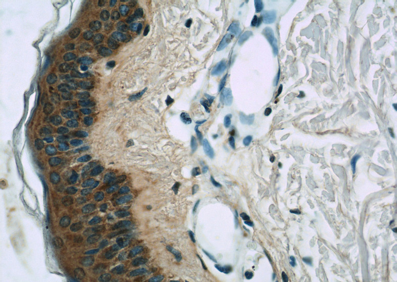 Immunohistochemistry of paraffin-embedded human skin slide using Catalog No:113873(PIK3CB Antibody) at dilution of 1:50