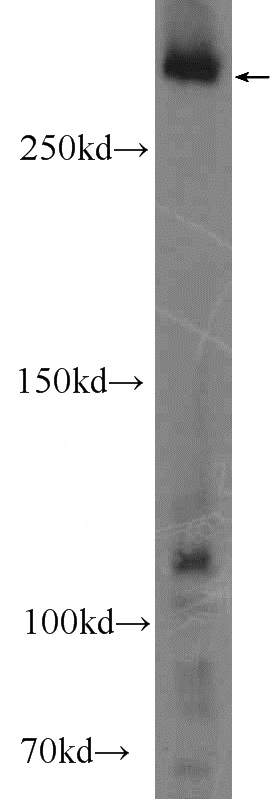 mouse brain tissue were subjected to SDS PAGE followed by western blot with Catalog No:110076(DMXL2 Antibody) at dilution of 1:200