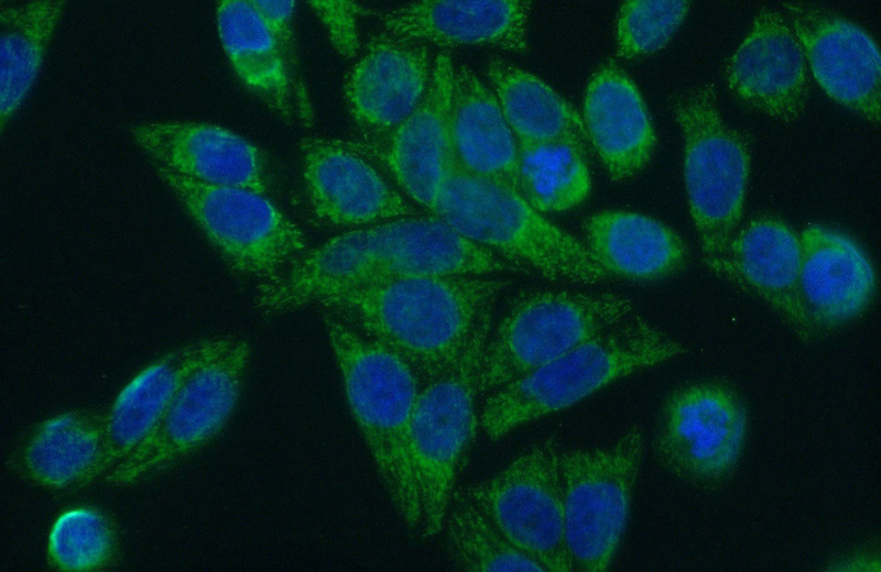 Immunofluorescent analysis of (10% Formaldehyde) fixed HeLa cells using Catalog No:111555(HSDL2 Antibody) at dilution of 1:50 and Alexa Fluor 488-congugated AffiniPure Goat Anti-Rabbit IgG(H+L)