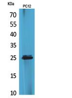 Fig1:; Western Blot analysis of PC12 cells using CMTM5 Polyclonal Antibody.. Secondary antibody（catalog#: HA1001) was diluted at 1:20000