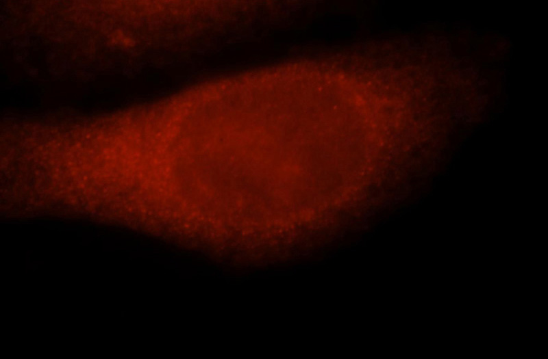 Immunofluorescent analysis of HepG2 cells, using TYMS antibody Catalog No:116115 at 1:25 dilution and Rhodamine-labeled goat anti-rabbit IgG (red).