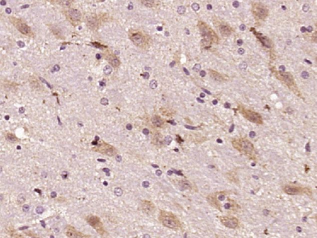 Fig2: Paraformaldehyde-fixed, paraffin embedded (Rat brain); Antigen retrieval by boiling in sodium citrate buffer (pH6.0) for 15min; Block endogenous peroxidase by 3% hydrogen peroxide for 20 minutes; Blocking buffer (normal goat serum) at 37℃ for 30min; Antibody incubation with (KIAA1598) Polyclonal Antibody, Unconjugated at 1:400 overnight at 4℃, followed by operating according to SP Kit(Rabbit) (sp-0023) instructionsand DAB staining.