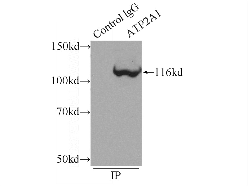 IP Result of anti-ATP2A1 (IP:Catalog No:108347, 5ug; Detection:Catalog No:108347 1:700) with mouse skeletal muscle tissue lysate 2160ug.