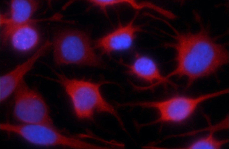Immunofluorescent analysis of C6 cells using Catalog No:107506(Scpep1 Antibody) at dilution of 1:25 and Rhodamine-Goat anti-Mouse IgG