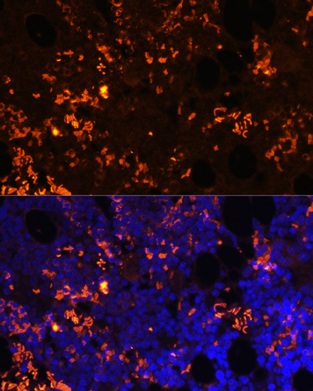 Immunofluorescence - GPR55 Polyclonal Antibody 