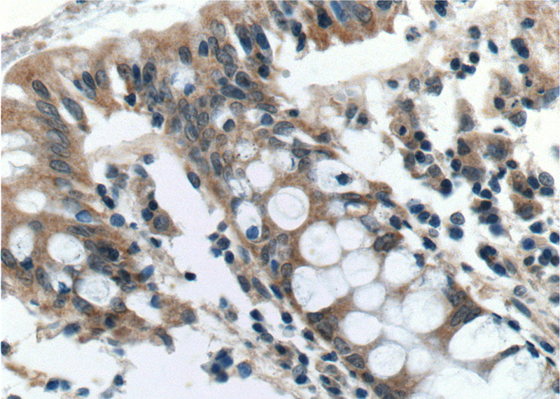 Immunohistochemistry of paraffin-embedded human colon tissue slide using Catalog No:108112(AOAH Antibody) at dilution of 1:50 (under 40x lens)