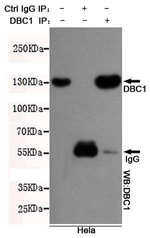 Immunoprecipitation analysis of Hela cell lysates using DBC1 mouse mAb.