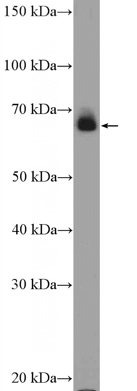 mouse skin tissue were subjected to SDS PAGE followed by western blot with Catalog No:109804(KRT1-specific Antibody) at dilution of 1:1000