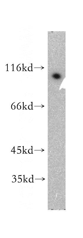 Apoptosised HeLa cells were subjected to SDS PAGE followed by western blot with Catalog No:113156(NFKB2 antibody) at dilution of 1:300